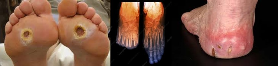 Lágylézer kezelés