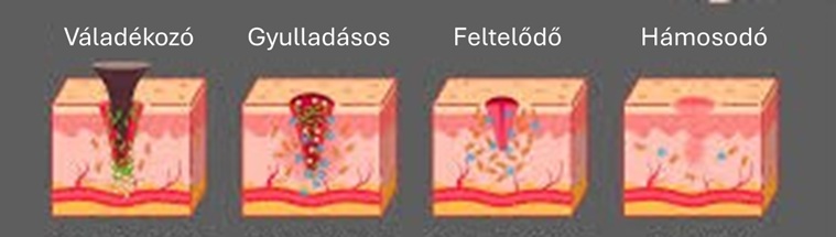 A sebgyógyulás stádiuma megszabja a kezelés menetét